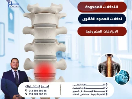 التدخلات المحدودة للعمود الفقري