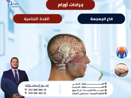 جراحات أورام قاع الجمجمة والغدة النخامية