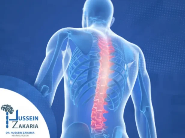 التدخلات المحدودة للعمود الفقري