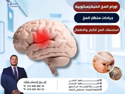 جراحات أورام المخ التشخيص والعلاج