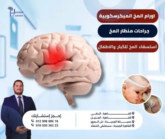 جراحات أورام المخ التشخيص والعلاج