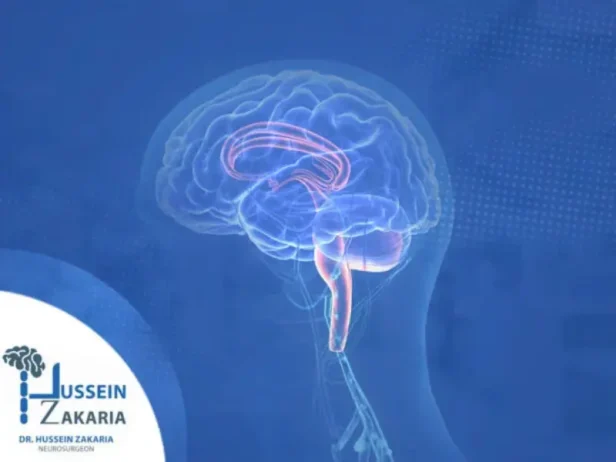 جراحات تشوهات الجمجمة والجهاز العصبي للأطفال