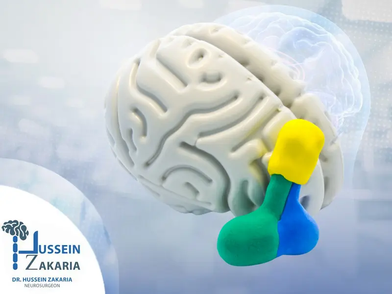 تكلفة عملية إزالة ورم الغدة النخامية في مصر 2025