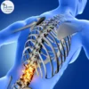 عملية تثبيت الفقرات