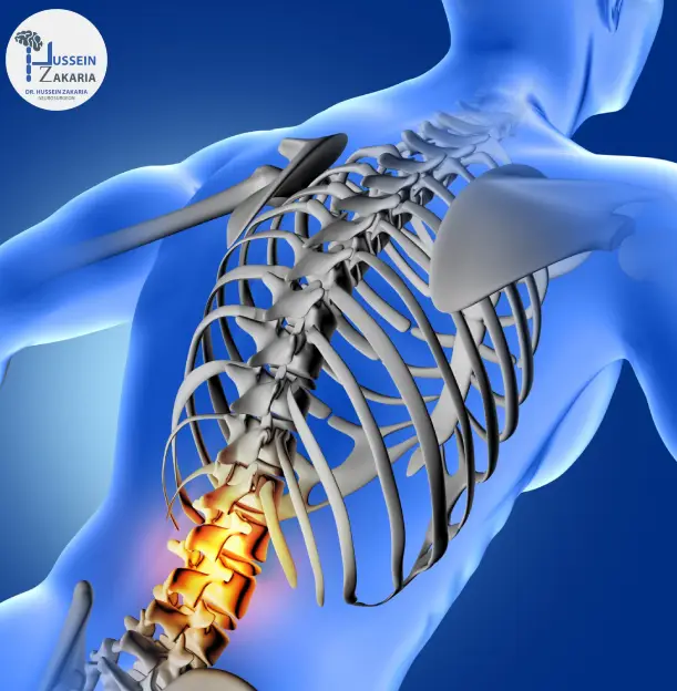 عملية تثبيت الفقرات؟