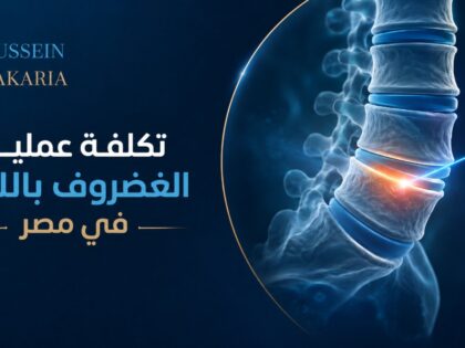 تكلفة عملية الغضروف بالليزر في مصر 2026