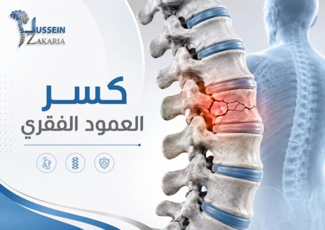 كسر العمود الفقري