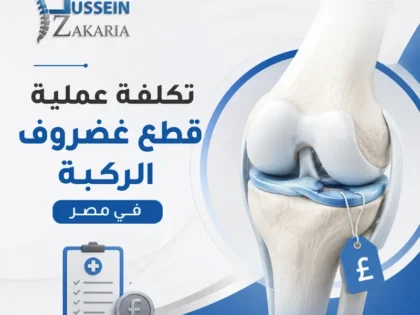 تكلفة عملية قطع غضروف الركبة في مصر 2026 حسب نوع الإجراء