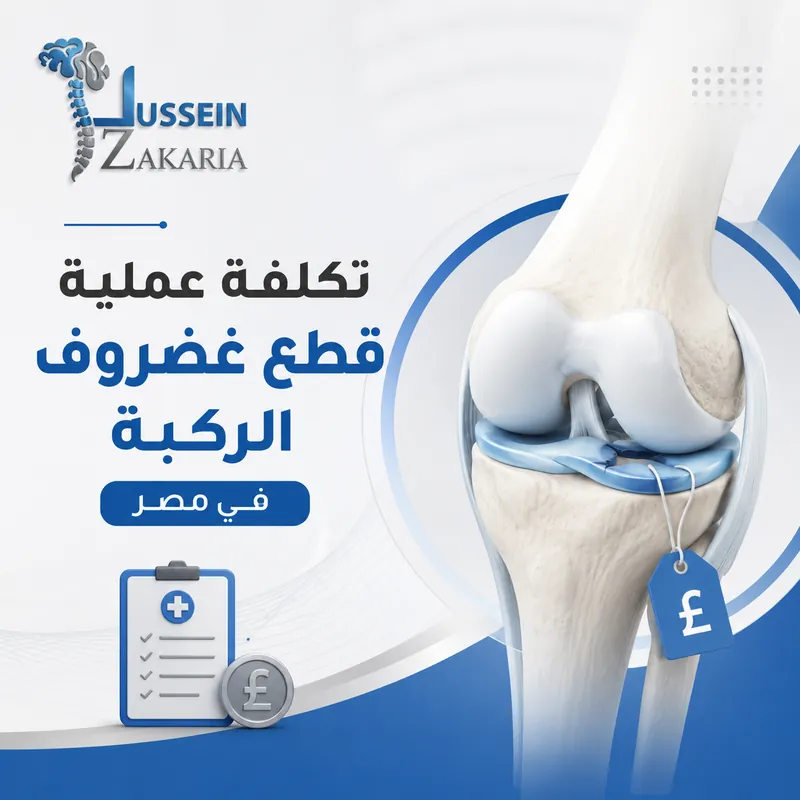 تكلفة عملية قطع غضروف الركبة
