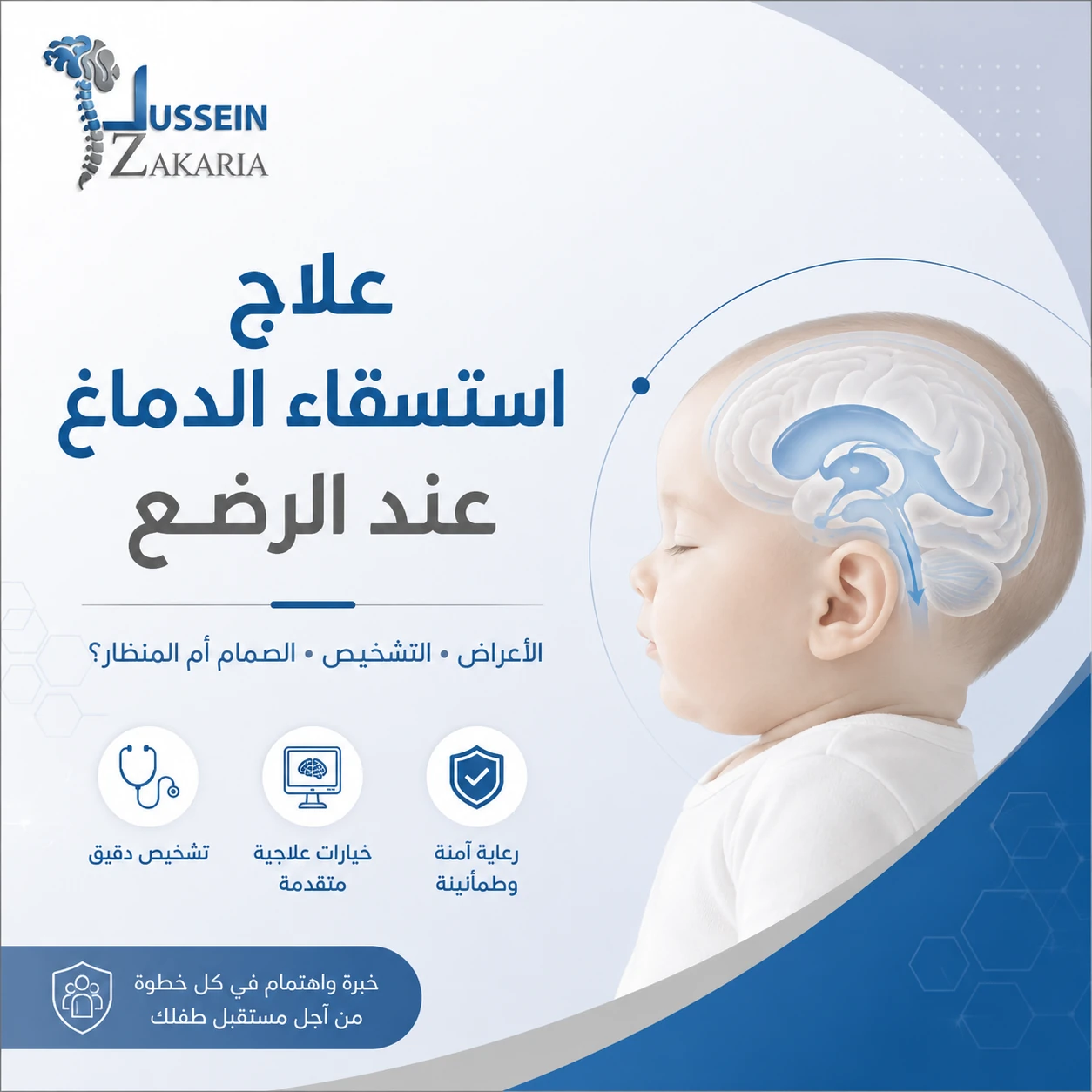 علاج استسقاء الدماغ عند الرضع
