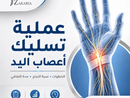 عملية تسليك أعصاب اليد: الخطوات ونسبة النجاح ومدة التعافي